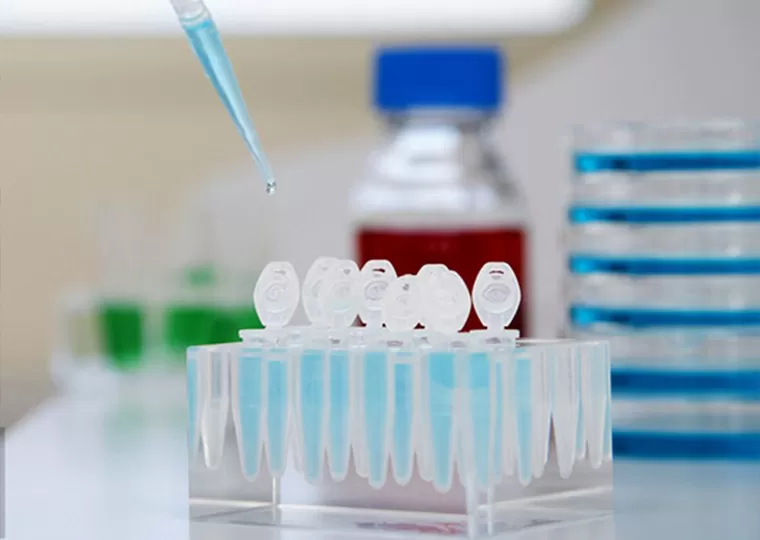 شاشة المواد الخام