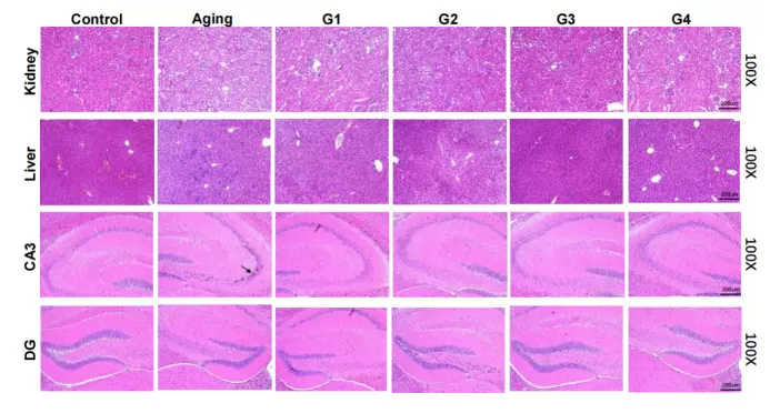 نتائج مقنعة في نموذج الشيخوخة الطبيعية