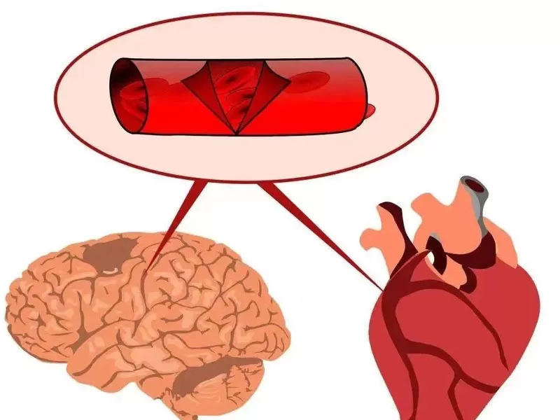 سلسلة مكافحة الشيخوخة: ريسفيرترول