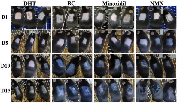 NMN ونمو الشعر: دليل جديد في الثعلبة الأندروجينية (AGA)
